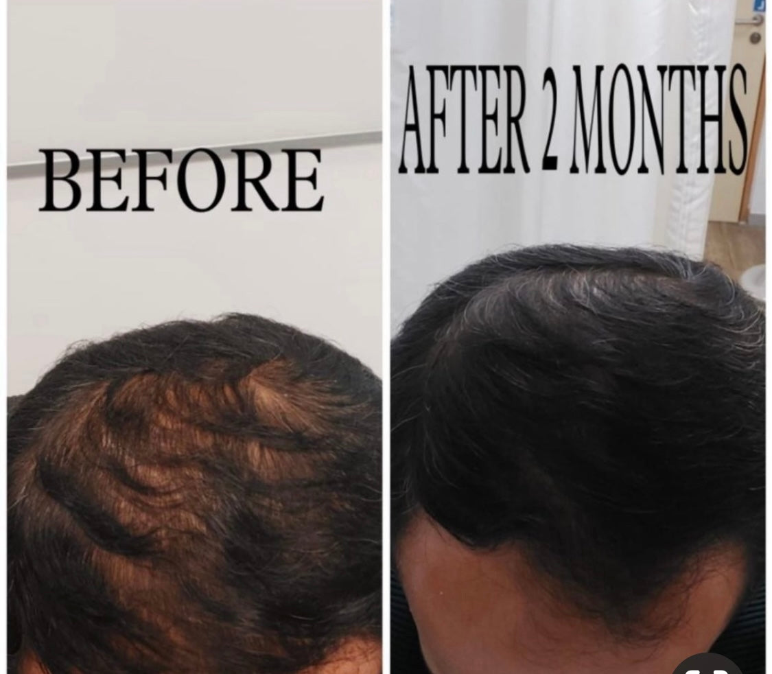 Hair Growth Oil
