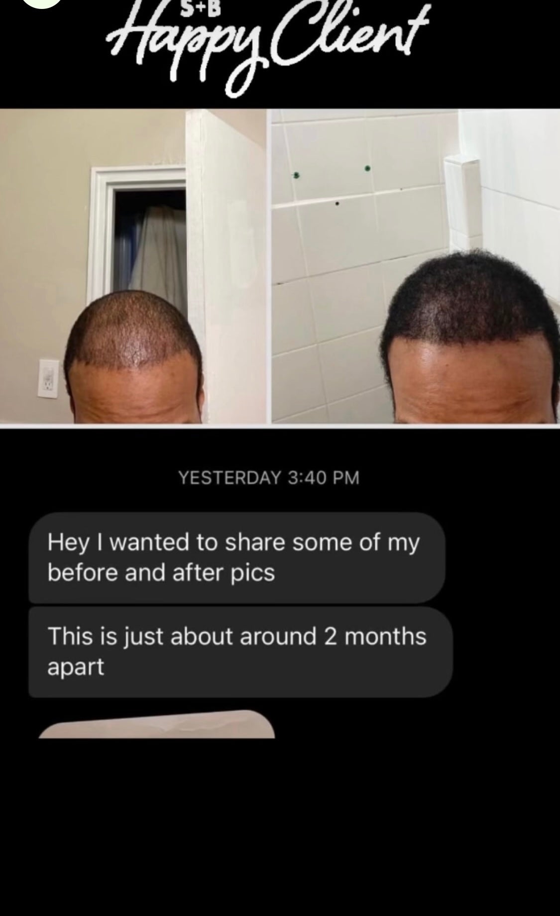 Hair Growth Oil