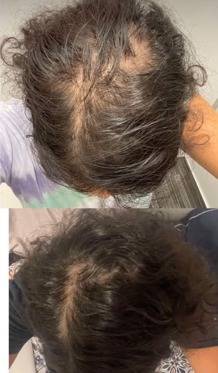 Hair Growth Spray
