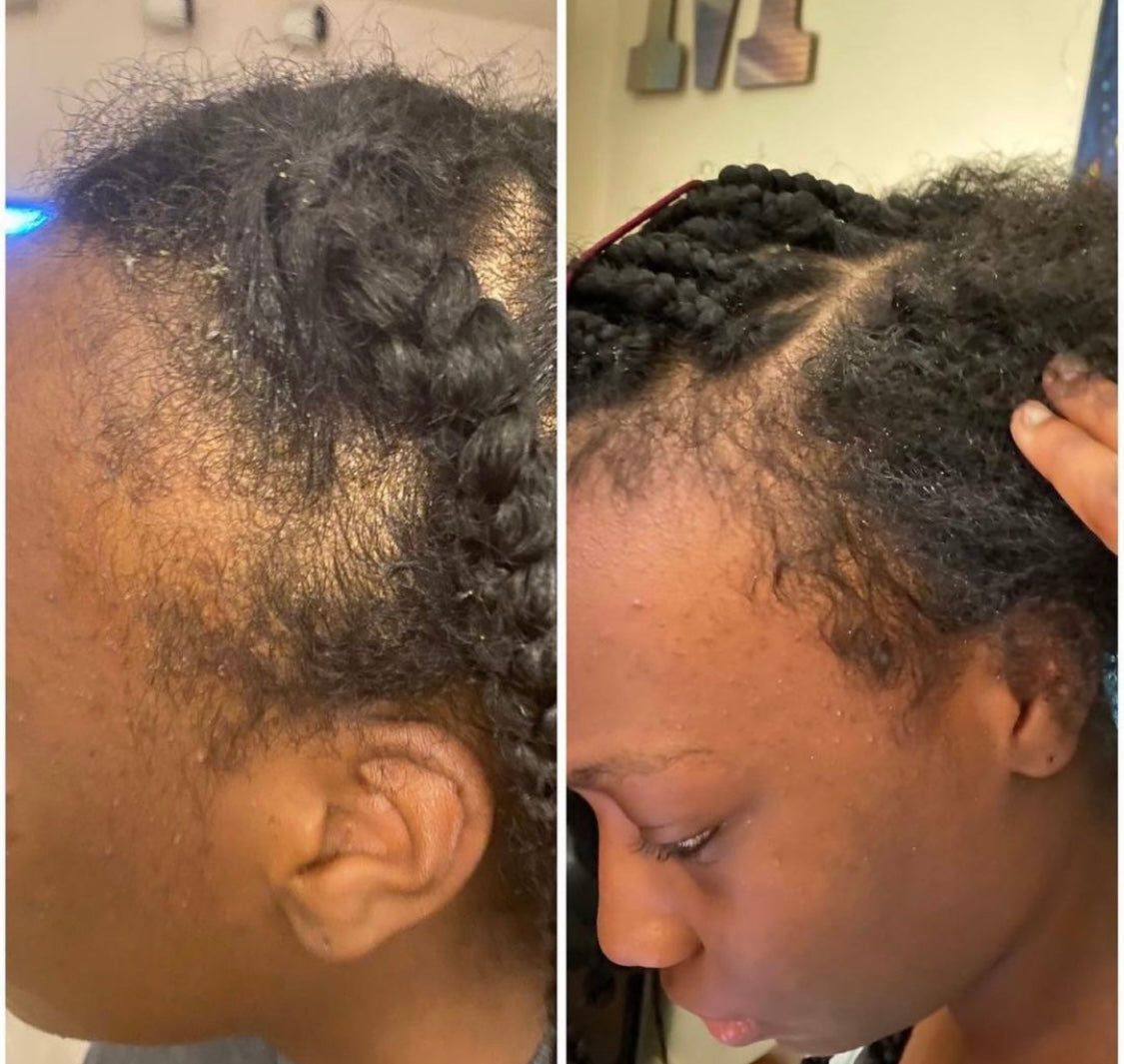 Hair Growth Oil