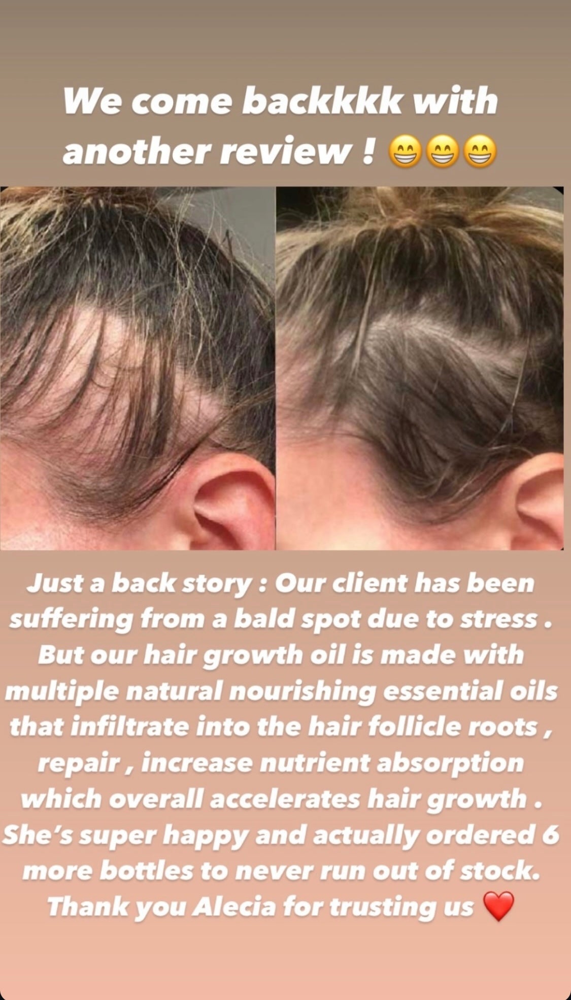 Hair Growth Oil